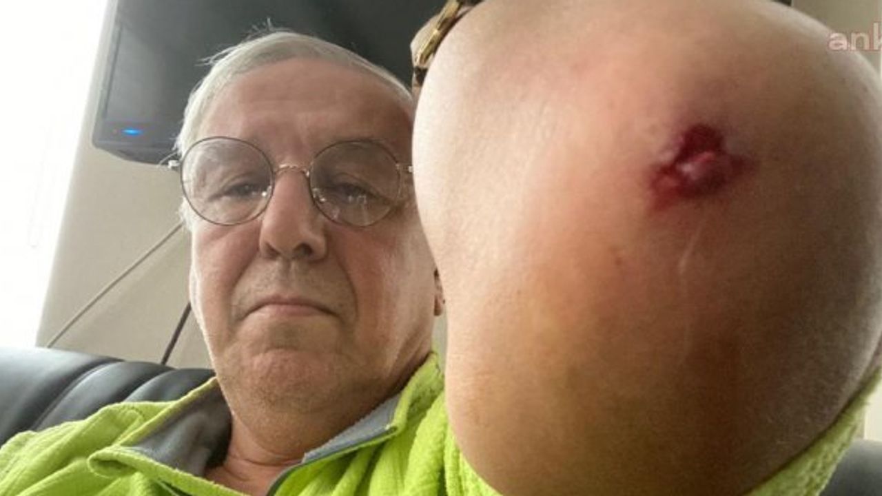 Gazeteci Orhan Uğuroğlu da saldırıya uğradı