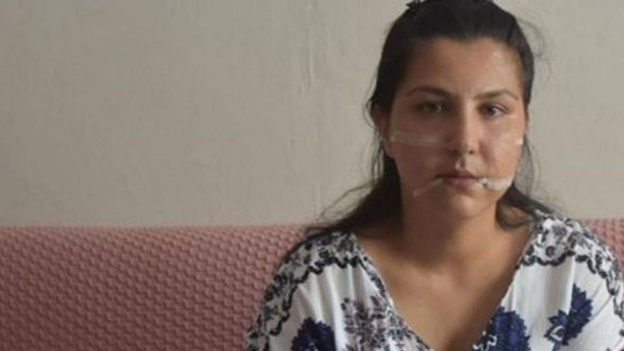 104 yerinden bıçakladı: Can çekişirken başında sigara içmiş...