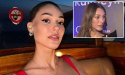 Dilan Çiçek Deniz’in yüzündeki değişim olay oldu!
