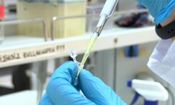 SMA'da ilaç tedavisi için kök hücre temelli test