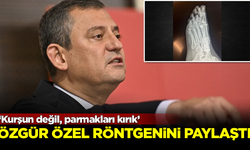 Özgür Özel röntgen görüntülerini paylaştı! 'Kurşun değil parmaklarda kırık'