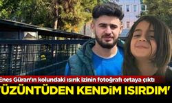 Enes Güran'ın kolundaki ısırık izinin fotoğrafı ortaya çıktı