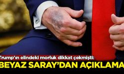 Trump'ın elindeki morluk dikkat çekmişti: Beyaz Saray'dan açıklama