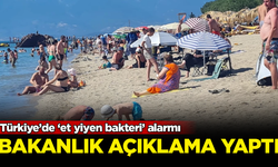 Türkiye'de 'et yiyen bakteri' alarmı! Bakanlık açıklama yaptı