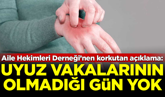 Aile Hekimleri Derneği'nden korkutan açıklama: Uyuz vakalarının olmadığı gün yok