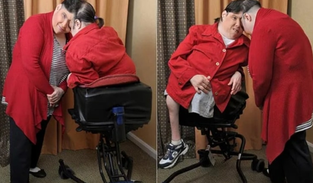 Dünyanın en yaşlı yapışık ikizleri, 62 yaşında hayata veda etti