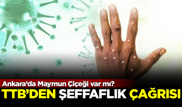 Ankara'da Maymun Çiçeği var mı? Tabipler Odası'ndan şeffaflık çağrısı yapıldı