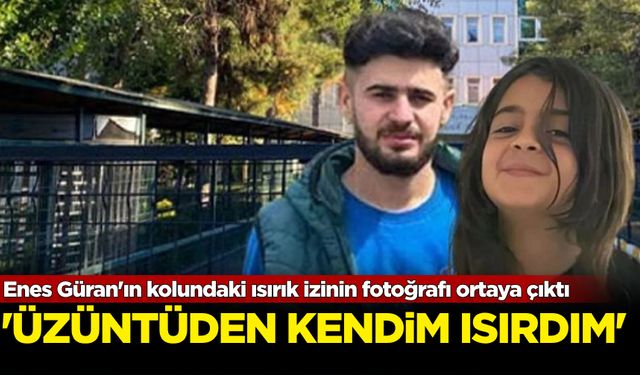 Enes Güran'ın kolundaki ısırık izinin fotoğrafı ortaya çıktı