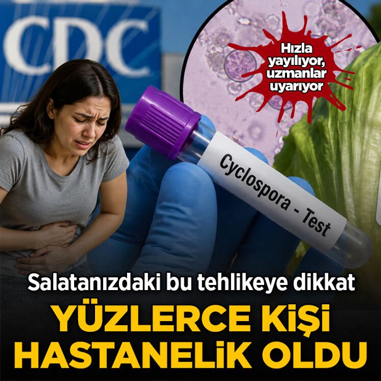 ABD'de parazit alarmı: Bağırsak enfeksiyonu vakaları 18 bini aştı
